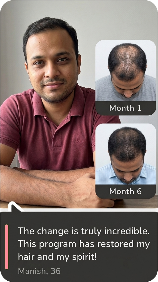 Manish, 36: The change is truly incredible. This program has restored my hair and my spirit!